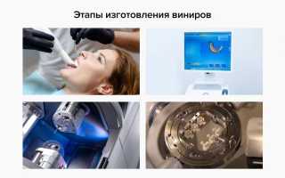 Керамические виниры E.Max