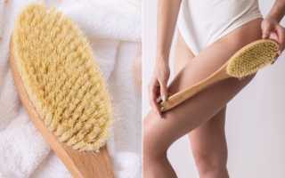 Почему появляются растяжки на теле и как с ними бороться в домашних условиях