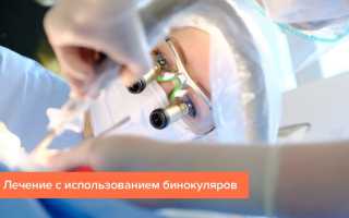 Признаки кариеса и как его распознать