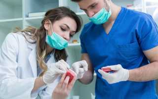 В чем отличие видов виниров?