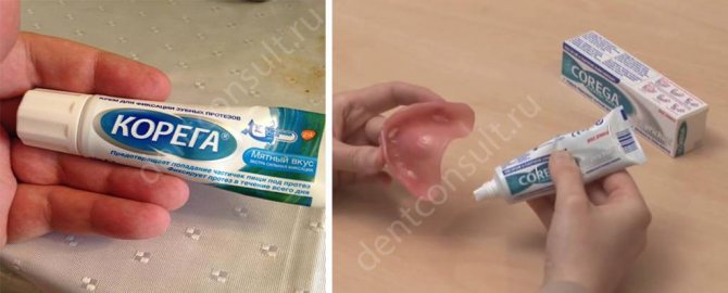 Фиксатор для протеза