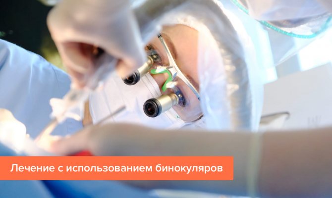 Фото лечения с использованием бинокуляров