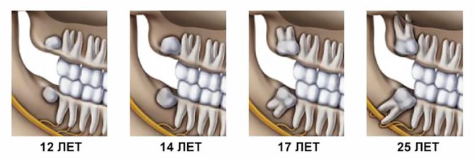 Зубы мудрости формируются после появления коренных