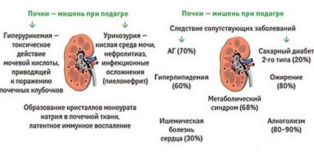 Хроническая почечная недостаточность подагра и как