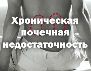 Проекция почек