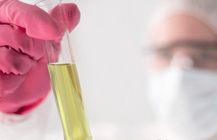 Норма лейкоцитов в моче у женщин